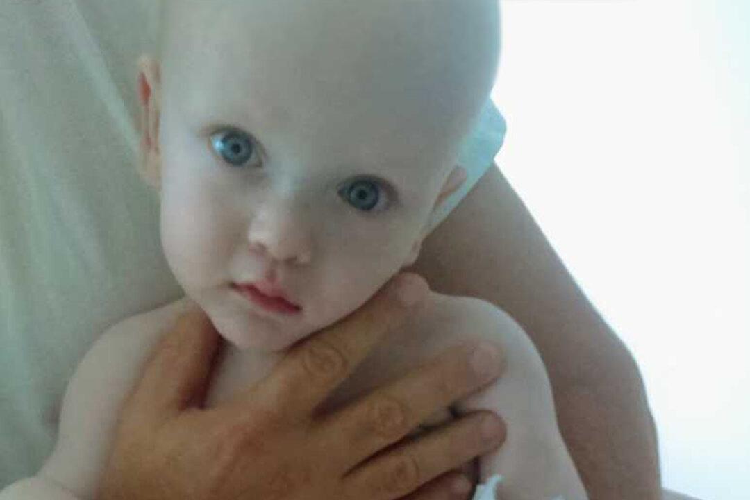 Abused Baby Who ‘Resembled an Alien’ Thrives With Loving Adoptive Family