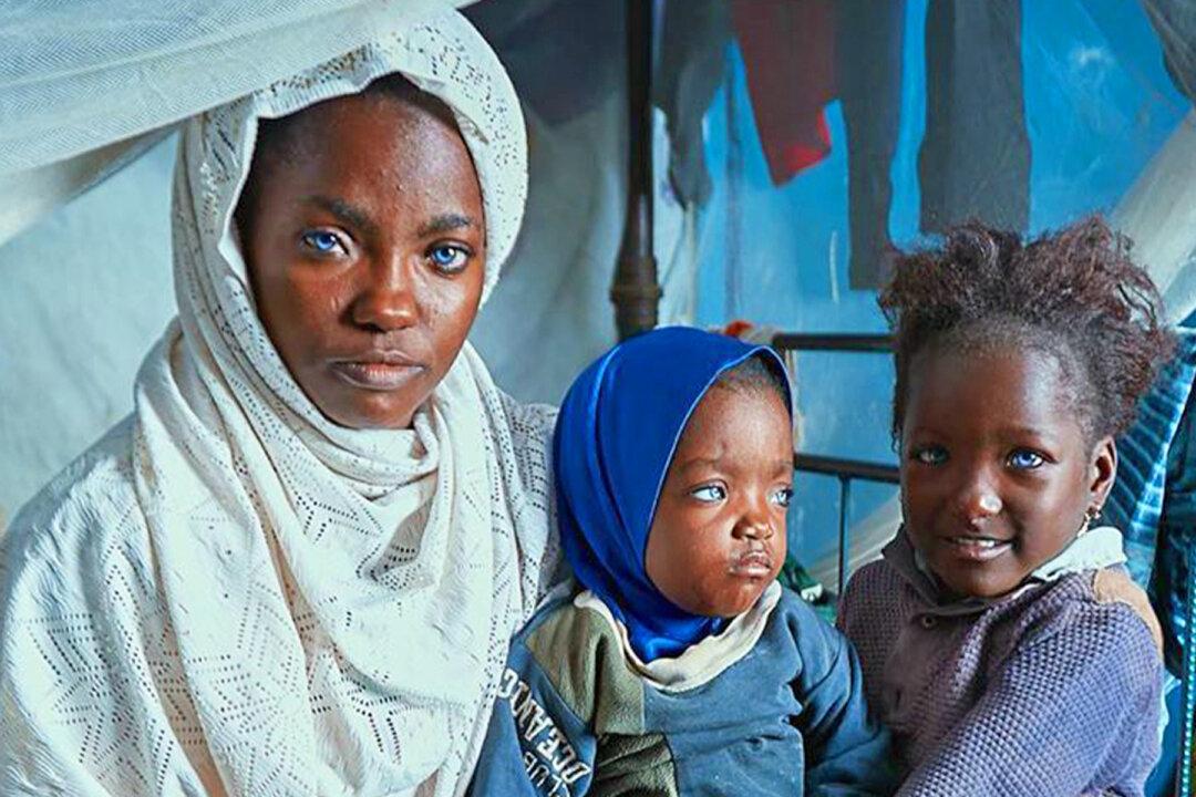 ‘Rare Blue-Eyed’ Mother, Kids Shunned by Husband Transform in Stunning Photoshoot