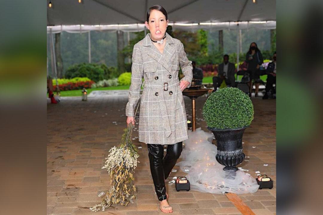 Mom-of-2 With Facial Abnormality That Doesn’t Allow Her to Smile Becomes a Model