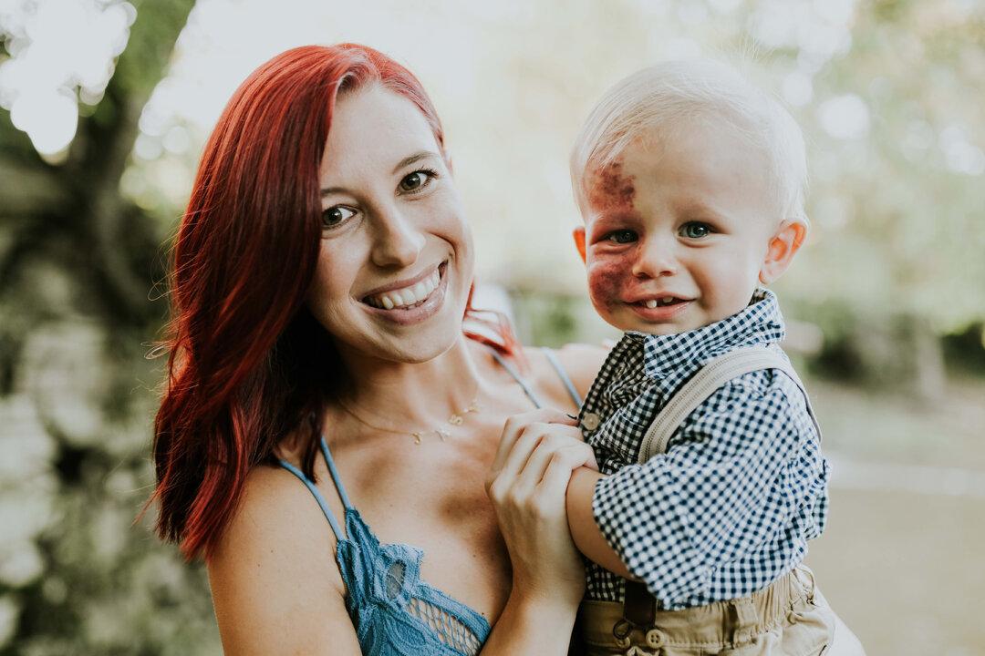 Adorable Baby Born With a Large Facial Birthmark Deemed ‘Perfect’ by Doting Mother