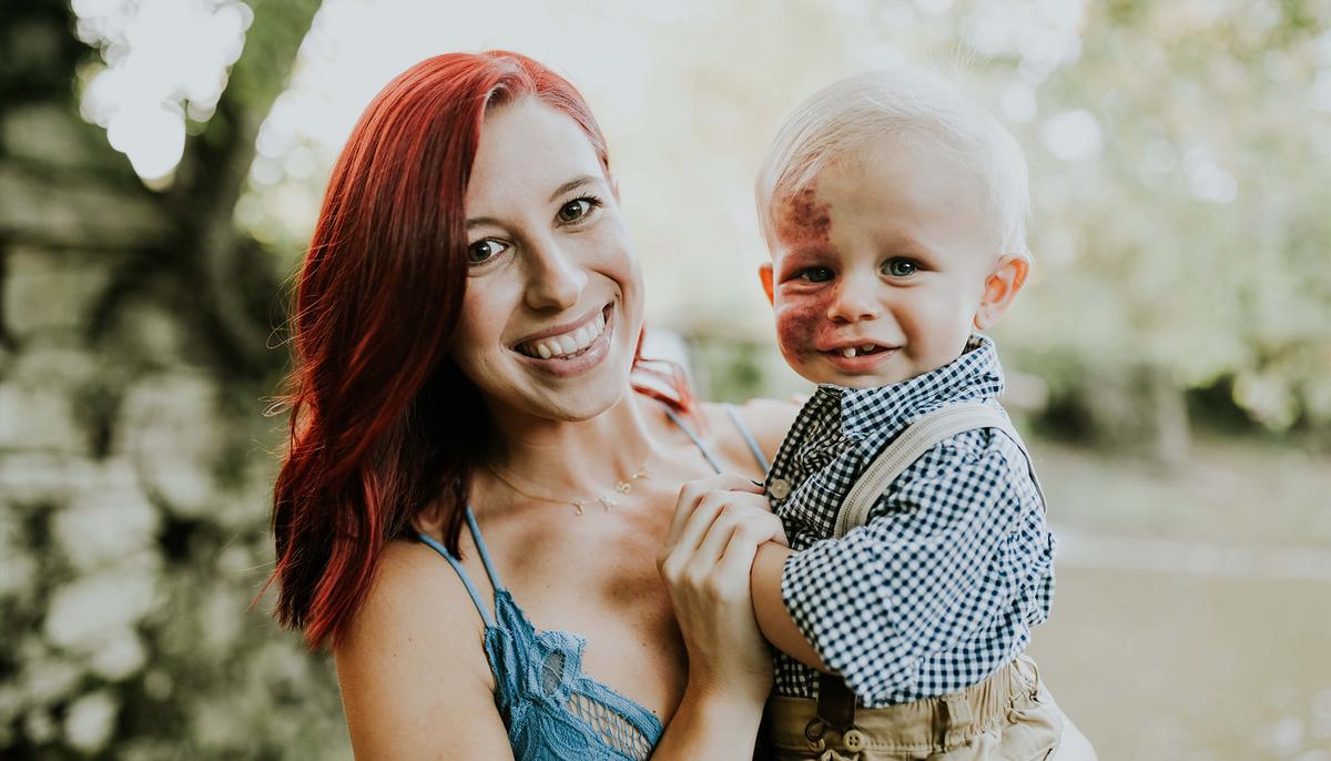 Adorable Baby Born With a Large Facial Birthmark Deemed ‘Perfect’ by Doting Mother