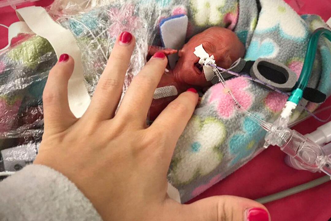 ‘World’s Most Premature Twins’ Celebrate Their 2nd Birthday After Beating the Odds