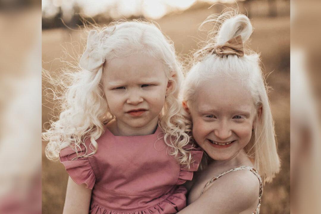 From Initial Fears to Developing a Fighting Spirit, Mom Raises Two Albino Daughters