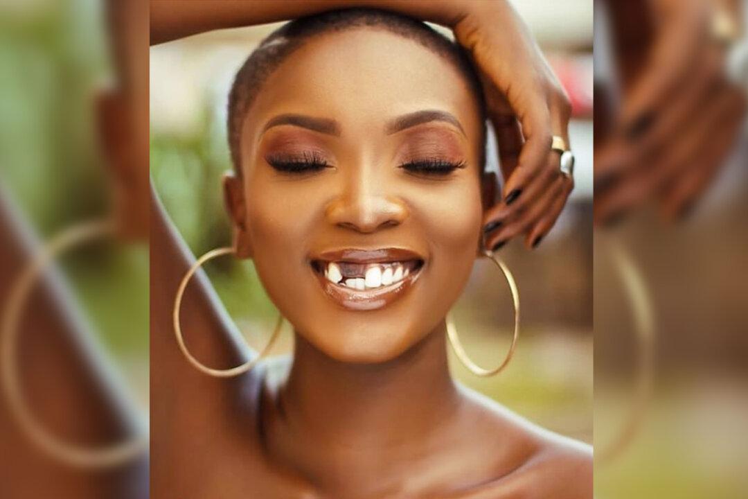 Model With an ‘Imperfect’ Smile Inspires People to Love Themselves and Find Beauty Within