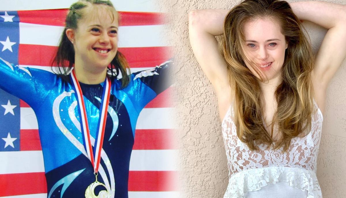 Girl With Down Syndrome Unable to Walk Until the Age of 2 Is Now a Special Olympian, Model