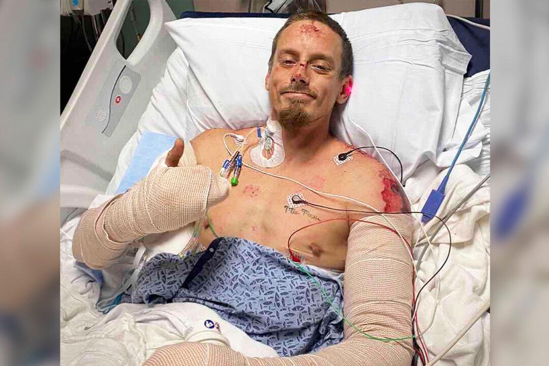 Georgia Man Saves His Whole Family From Housefire, Suffers Severe Burns to His Arms, Back