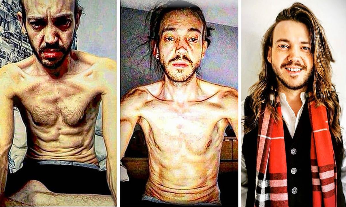 ‘I Was Broken’: Former Ketamine ‘Druggie’ Transforms His Life, Becomes Public Speaker