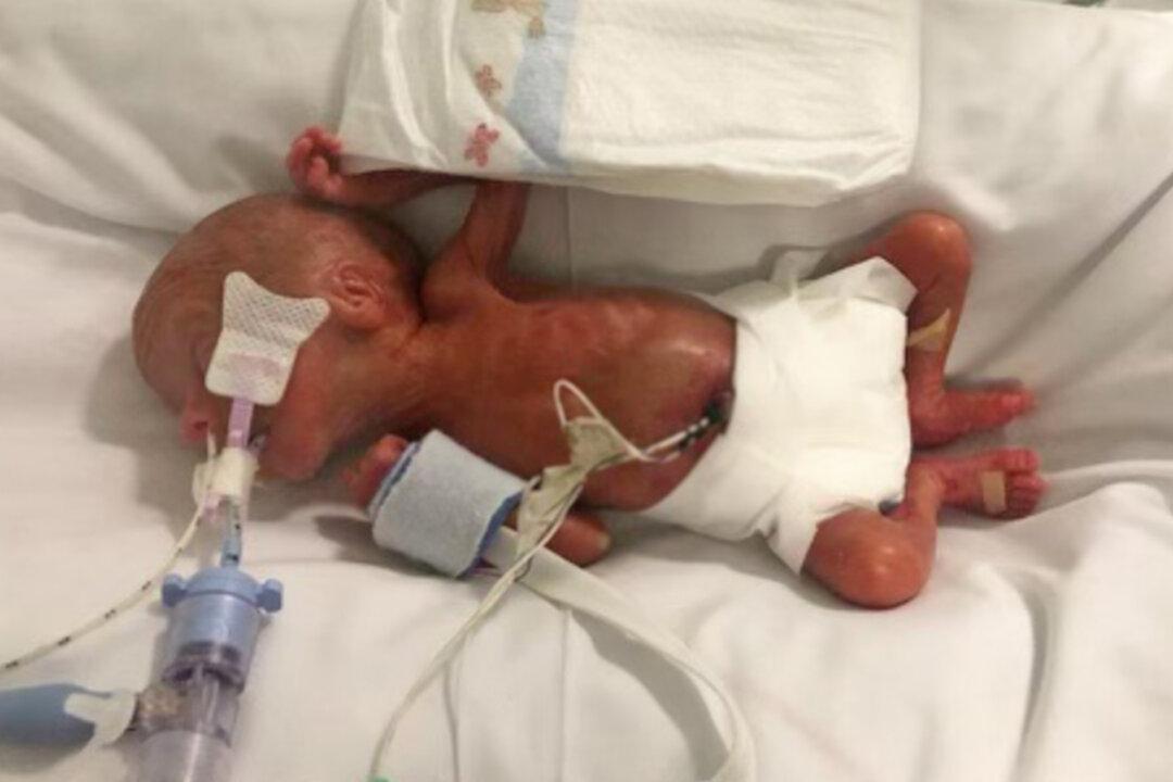 Parents of 1lb Preemie Who Were Forced to Say Goodbye Twice Prepare for His First Christmas