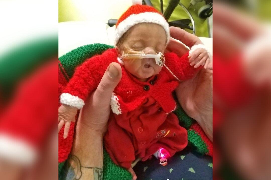 Preemie Turns One After Doctors Said Every Day for a Month She Wouldn’t Survive