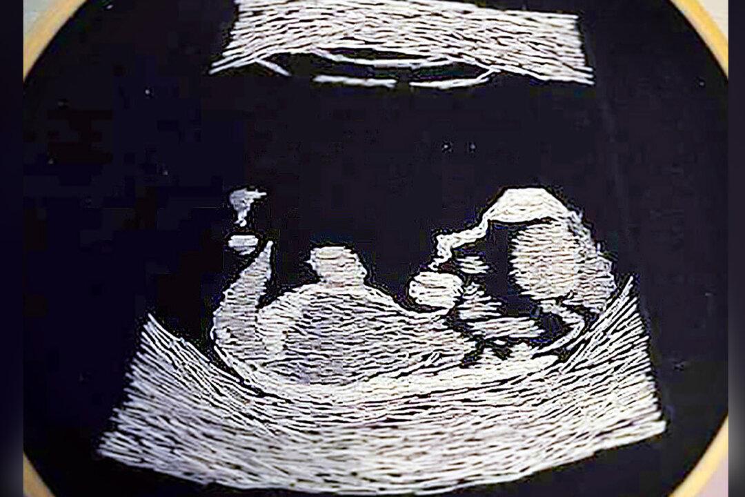 Blind Father-to-Be Can’t See Ultrasound Image–so Friend Embroiders Scan for Him to Feel