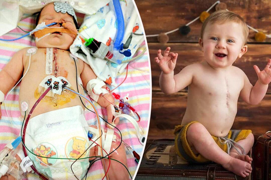 Tot With Rare Heart Defect ‘Died’ 9 Times, Still Smiles as Family Gives ‘as Many Days as Possible’