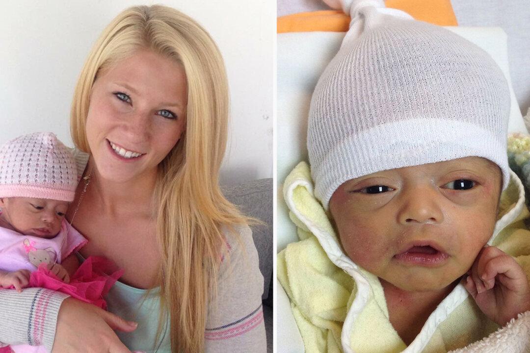 Woman Adopted Abandoned Baby With 3 Percent of Brain, Giving Her a Home While She Lived