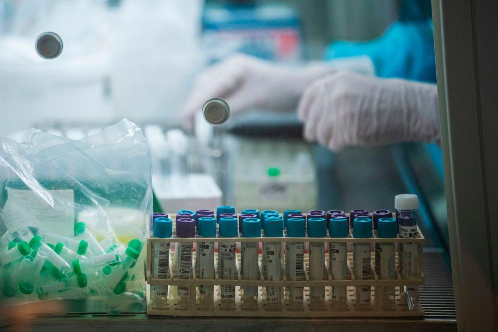 Most Recovered COVID-19 Patients Have Broad, Robust Immunity That Likely Provides Some Protection Against Variants: Study