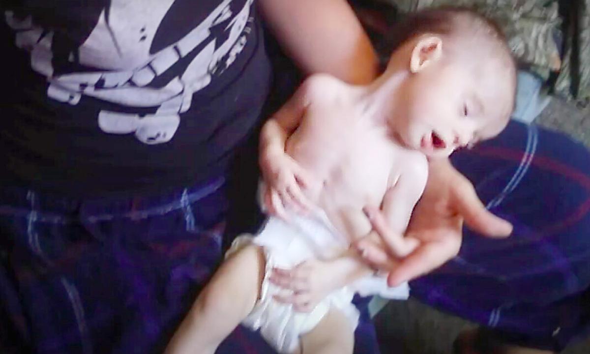 Neglected Baby Living in Filthy Trailer Saved by Deputy, Makes Amazing Transformation With New Family