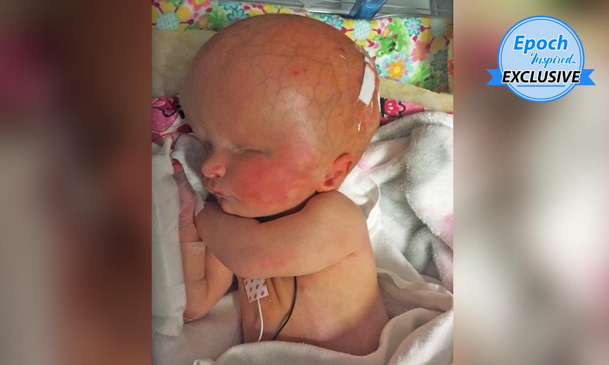 Girl Born With Two-Thirds of Her Brain Missing and No Eyeballs Defies Doctors’ Predictions