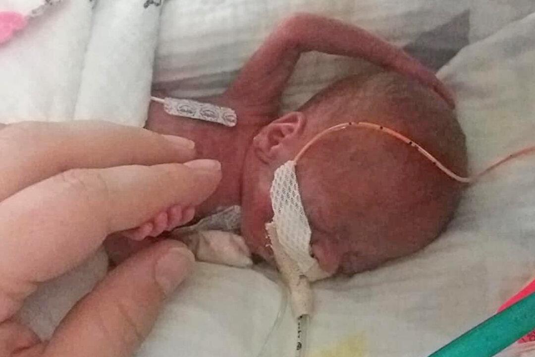 Baby Born at 21 Weeks Defies the Odds, Becomes One of the Youngest Babies to Survive