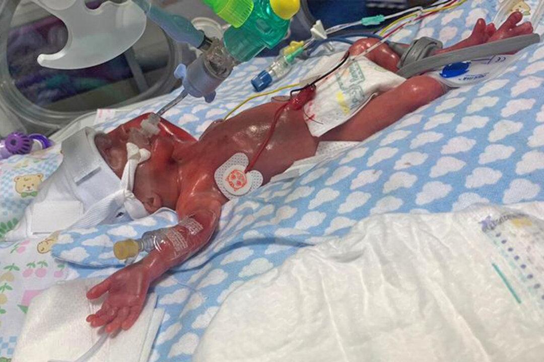 Miracle Baby Born at 23 Weeks as Mom Thought She Was Having a Miscarriage
