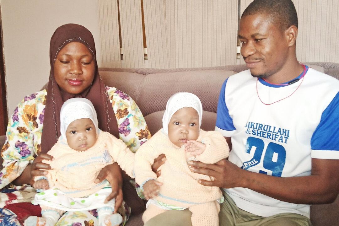 Conjoined Twin Girls Successfully Separated in Nigeria, Hospital Employs Struggling Parents