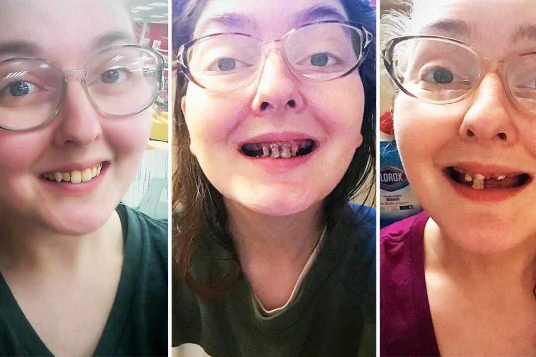 Woman Shares Scary Photos of Dental Decay in Span of 3 Years of Drinking Pop and No Brushing