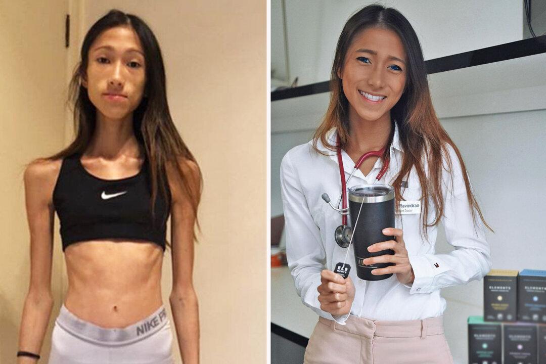 66lb Woman Recovers From Eating Disorder, Trains as Doctor in Hopes of Saving Others