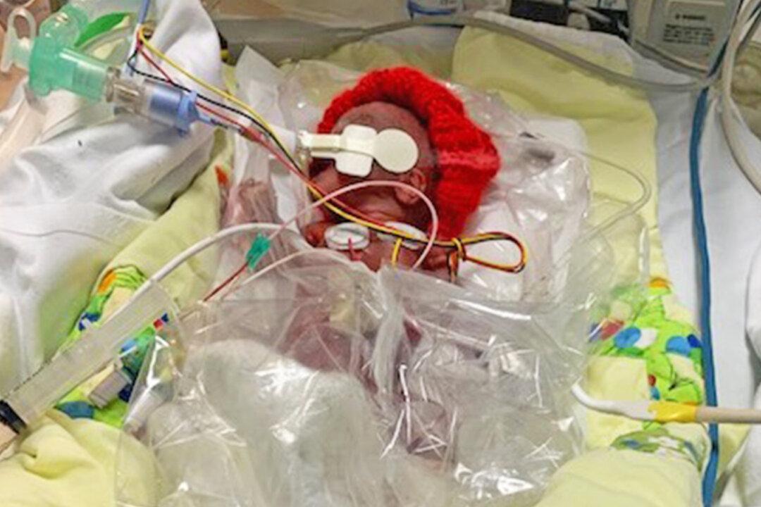 Miracle Preemie Who Was Born at 1lb 3oz Beats the Odds to Survive and Is Now 9 Months Old