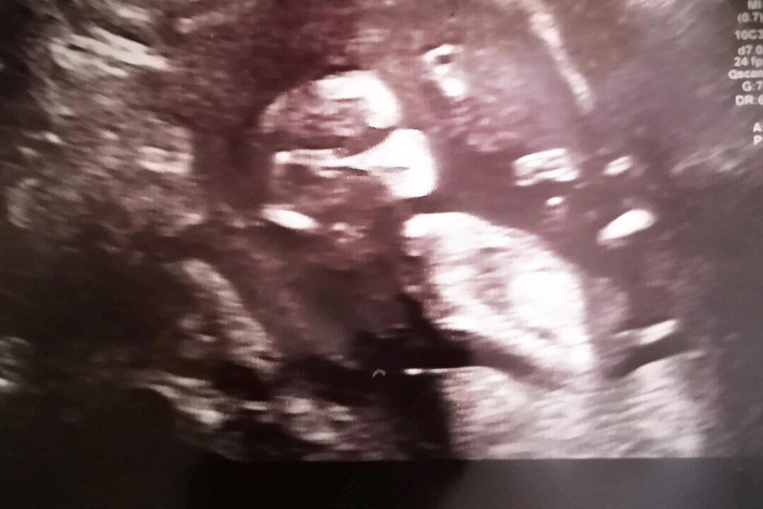 Pregnancy Scan Appears to Show Baby Wearing a Mask–as Mom Tests Positive for COVID