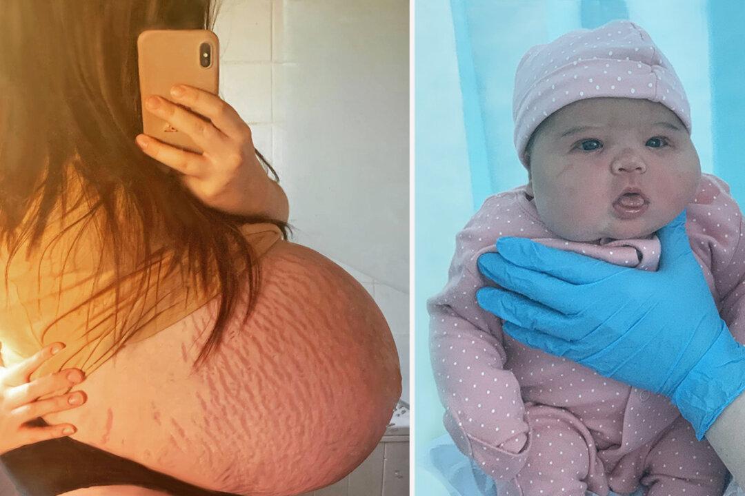 Woman With a Big Bump Which Doctors Thought Would Have Secret Twin Gives Birth to 13lb Baby