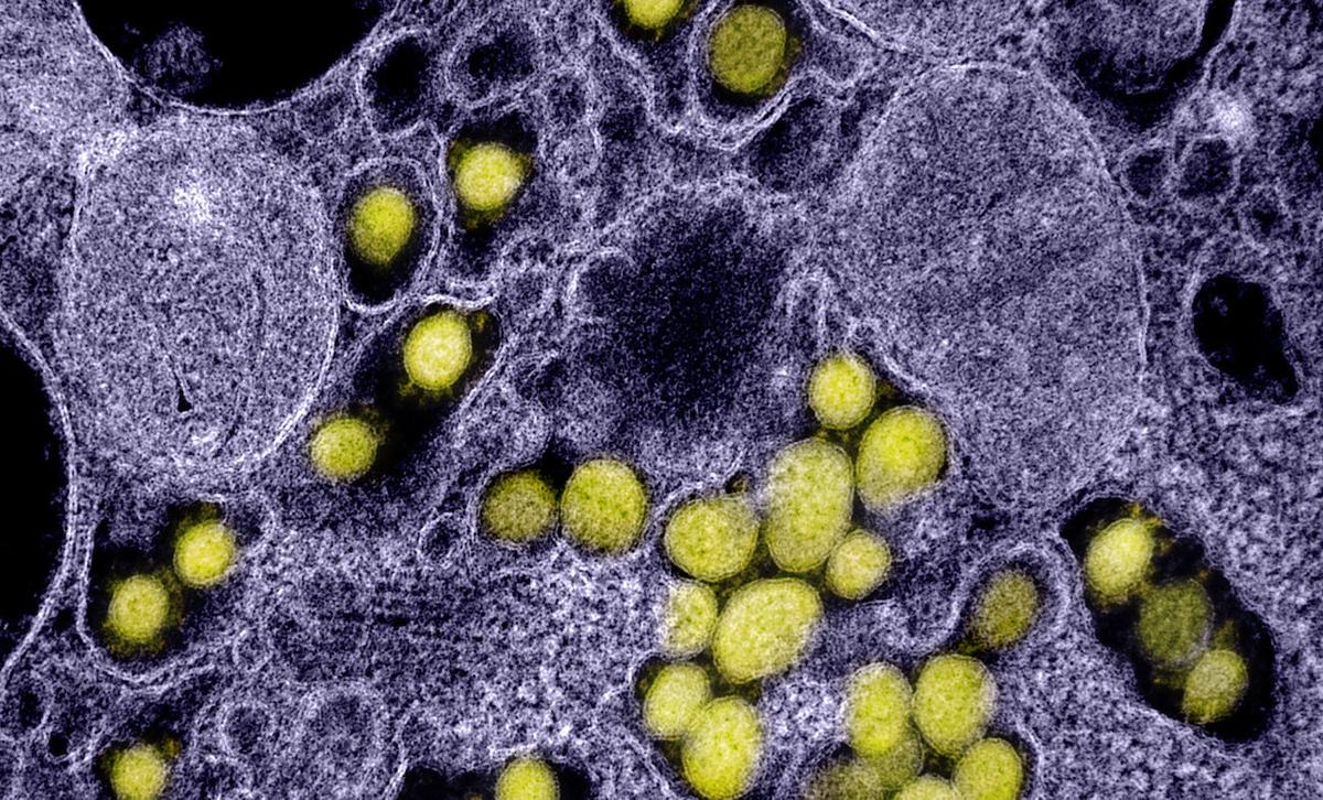 COVID-Infected People Without Symptoms Are Much Less Likely to Pass Virus On: Study
