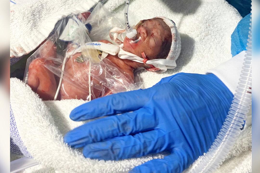One of Britain’s Most Premature Babies Born at Just 22 Weeks Defies Survival Odds