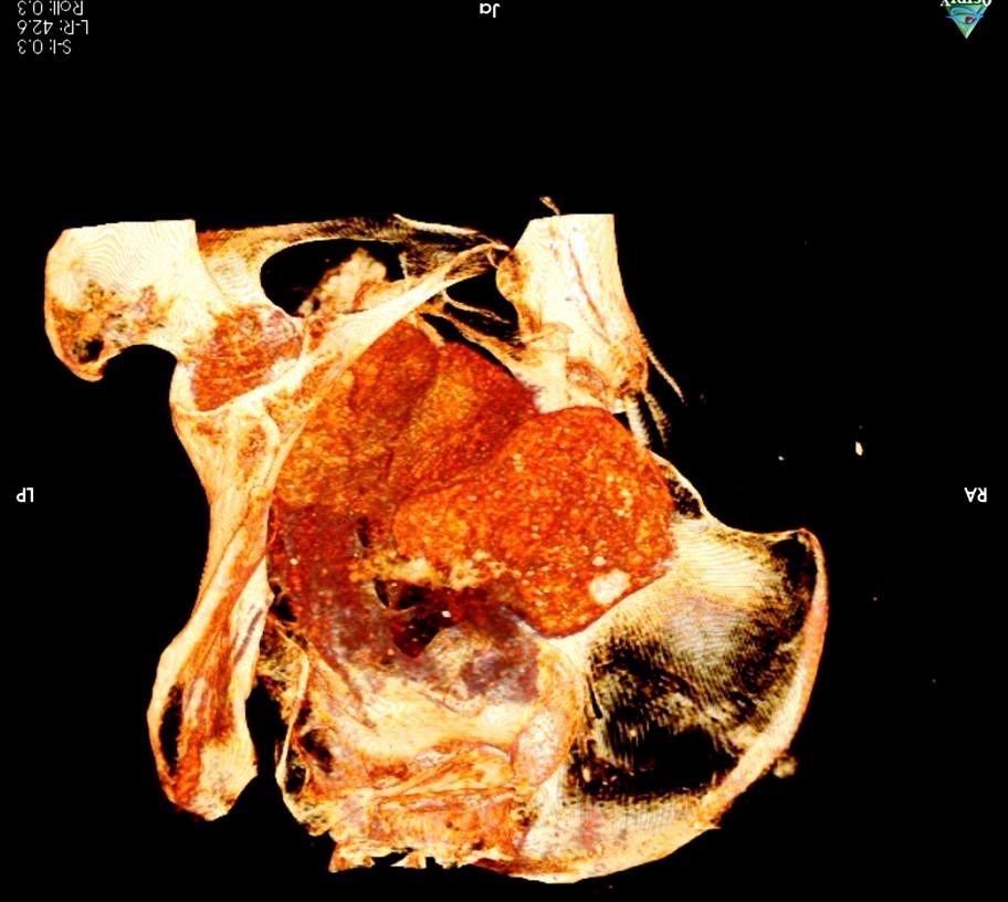 A CT scan of the mummy's pelvic region. (Courtesy of Marcin Jaworski/<a href="http://warsawmummyproject.com/en">Warsaw Mummy Project</a>)