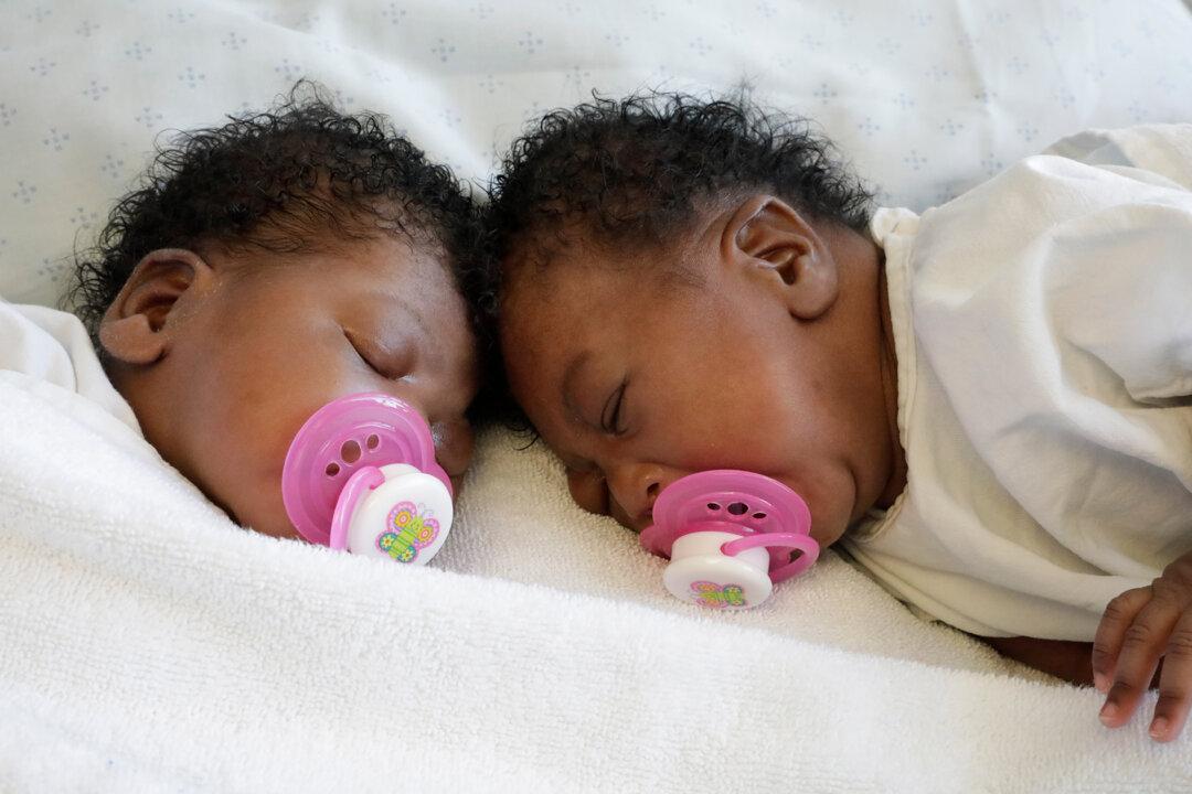One in 2.5 Million Births: Twin Baby Girls Joined at the Head Are Successfully Separated