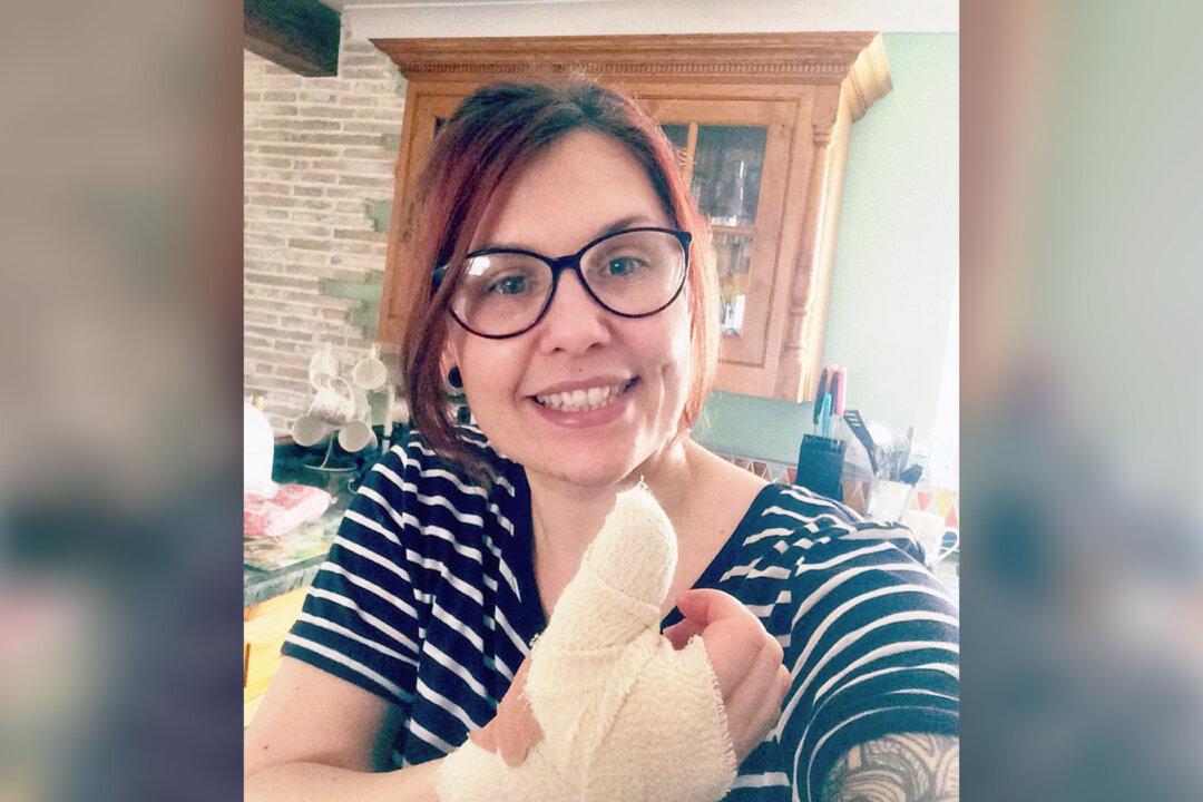 Woman Discovers Deadly Cancer After Reading an Article of a Tiny Line on Her Fingernail