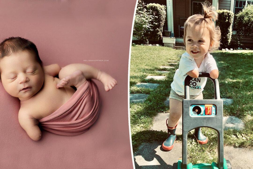 Mom of Baby Without Forearms Pens Letter to Doctor Who Advised Abortion: ‘I Remember You’