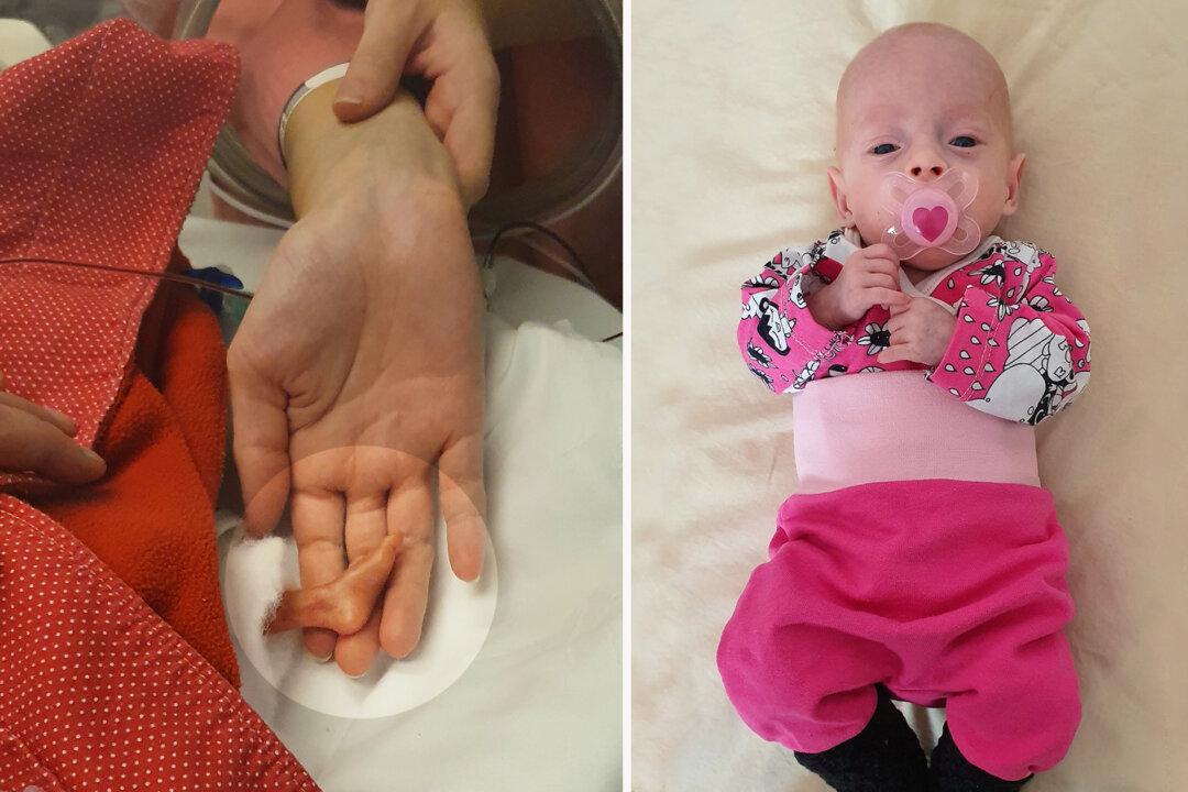 Over 1lb Preemie With Feet Half the Size of Her Mom’s Forefinger Defies Survival Odds
