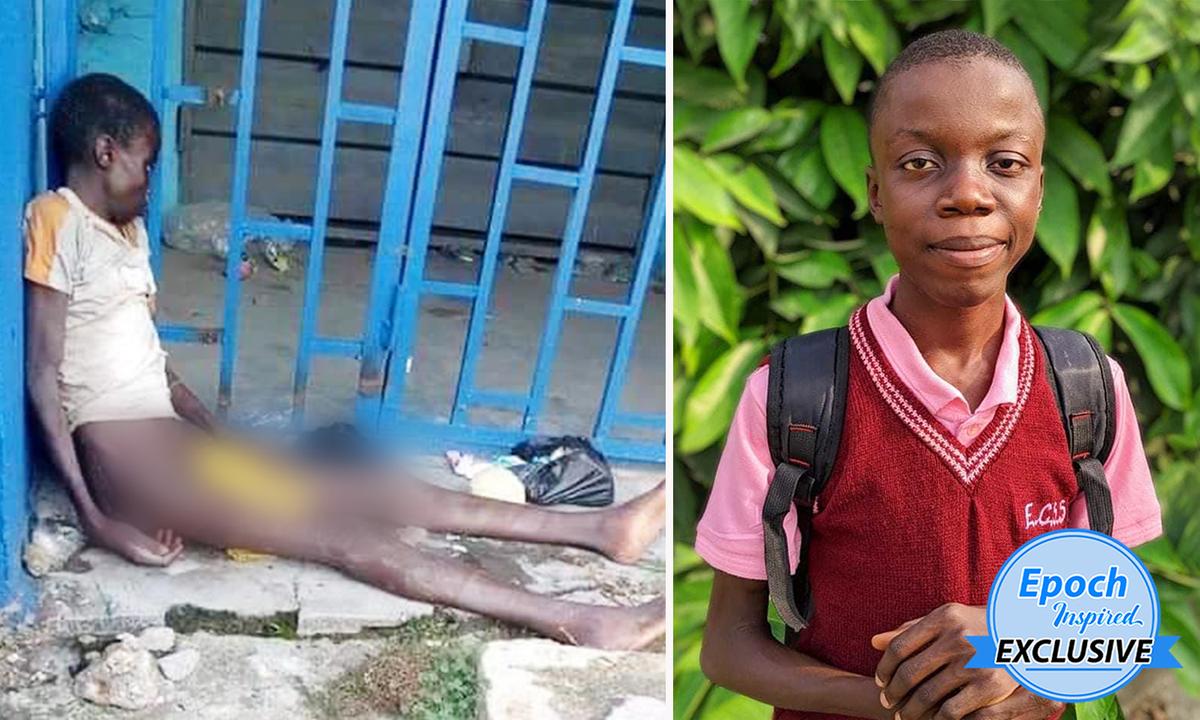 Boy Who Was Among ‘One of the Worst Child Abuse Cases’ Survives, Now Attends School