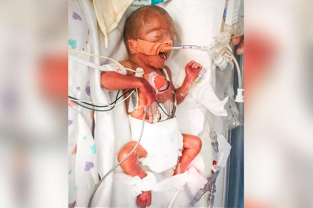 Baby Born Size of Sharpie Defies Incredible Odds of Survival; 4.5 Months Later, He’s a 7-Pound Miracle