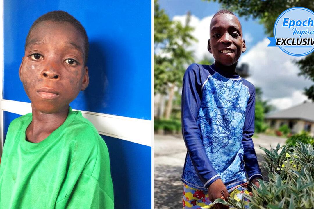 Naked Boy Found on the Street Tortured, Extremely Malnourished is Rescued and is Now Thriving