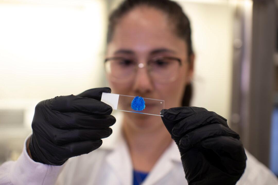 Cancer Patients’ Own Cells Used in 3D Printed Tumors to Test Treatments