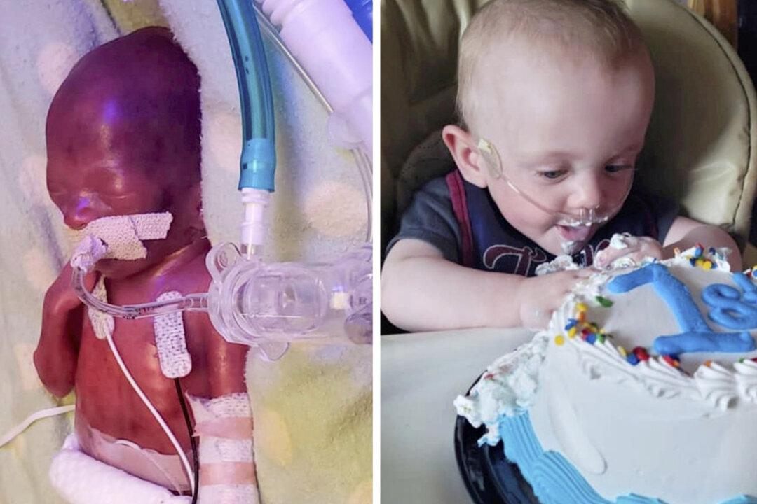 World’s Most Premature Baby Was Given Zero Percent Odds of Survival, He’s Now 1 and Is Thriving