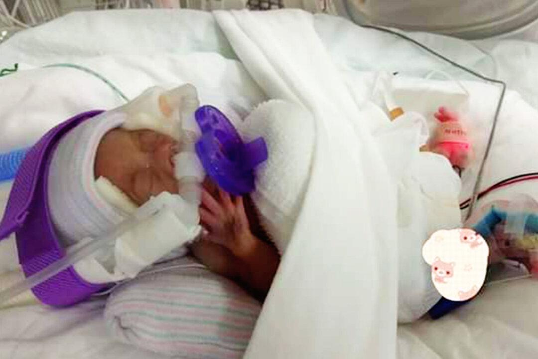 ‘World’s Lightest’ Baby, Born the Weight of an Apple, Goes Home After 13 Months in Hospital
