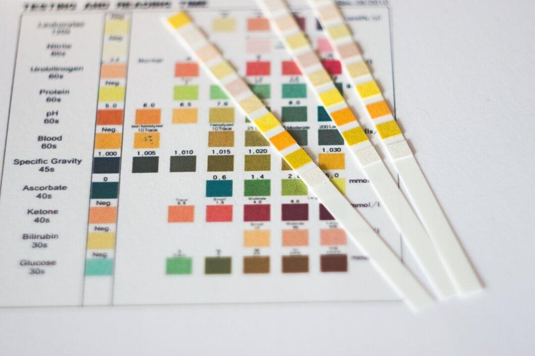 Dark Urine—Causes and When to Seek Treatment