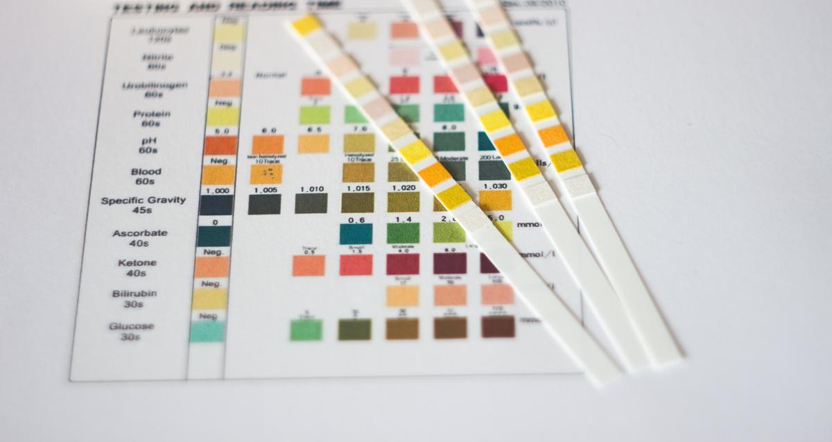 Dark Urine—Causes and When to Seek Treatment