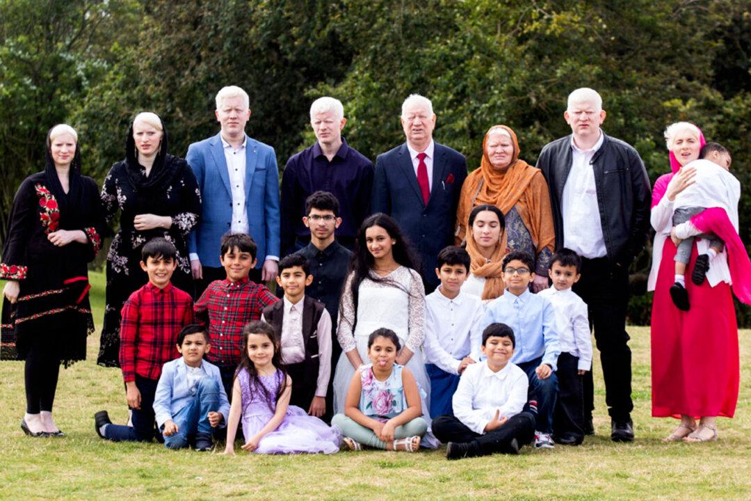 British-Asian Clan With 15 Albinos Might Be the World’s Biggest Family With the Condition