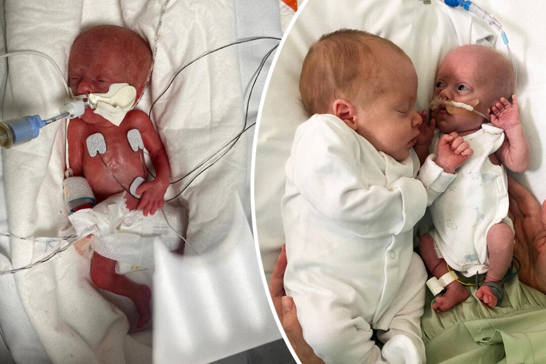 Parents Say Preemie Born Weighing 1lb Keeps ‘Fighting’ Due to Cuddles From Identical Twin