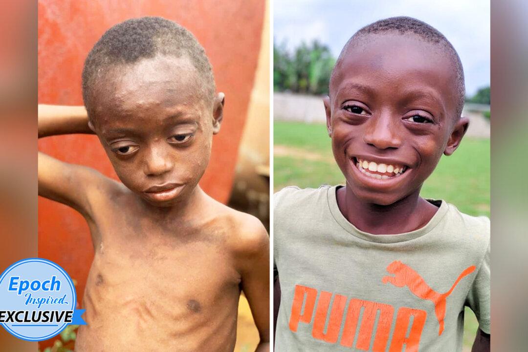 Severely Beaten and Left Alone to Die, Boy Becomes ‘Happiest Child’ After Rescue and Rehab