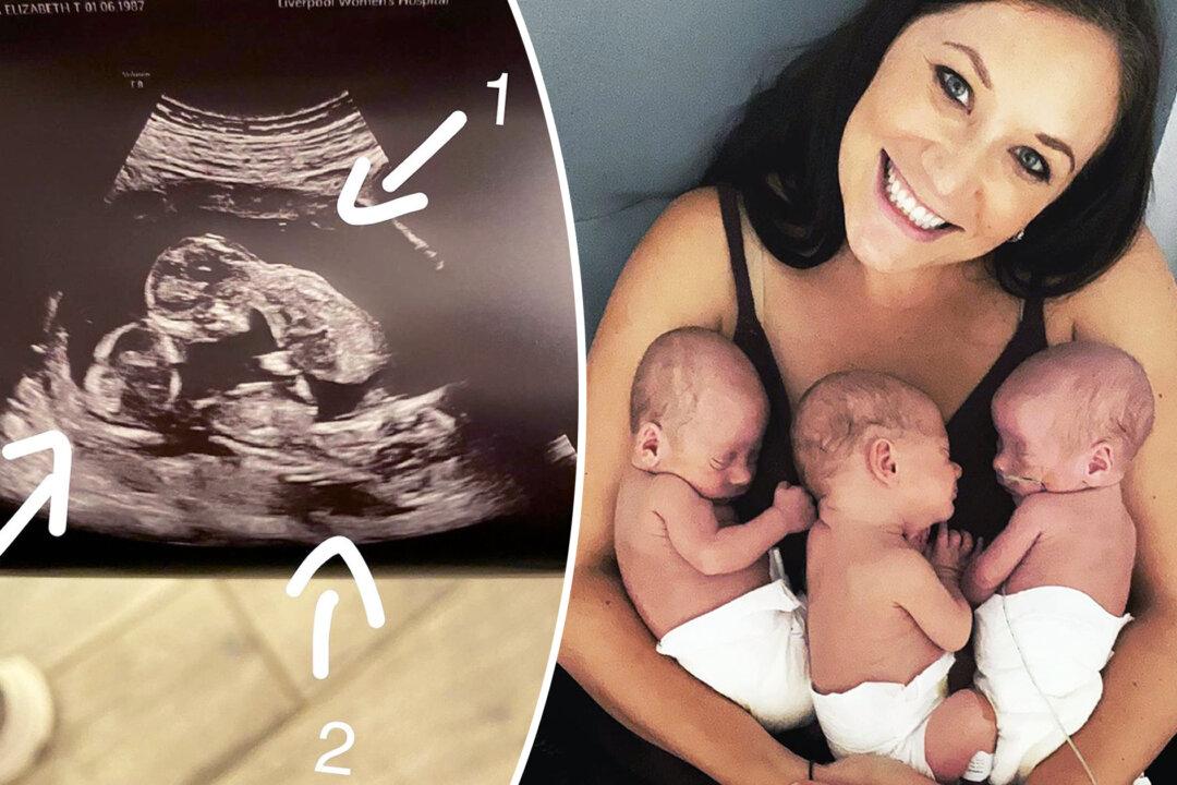 Mom Gives Birth to Rare 1-in-200-Million Triplets With One Baby Being Born in an Amniotic Sac
