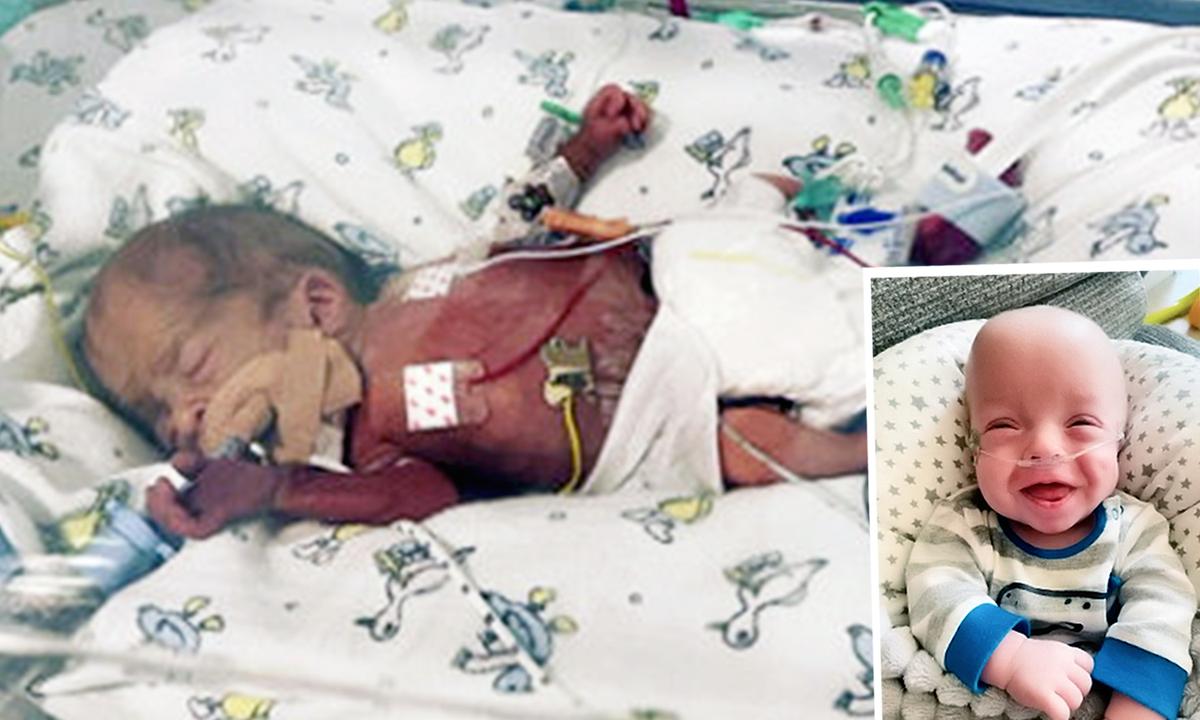 ‘1 Percent Chance’ Baby Whose Mom Refused Abortion at 20 Weeks Thrives: ‘Raise Awareness’