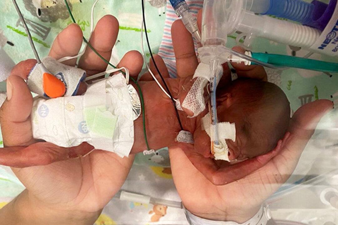 Boy With Less Than 1 Percent Survival Odds Breaks Record as World’s Most Premature Baby