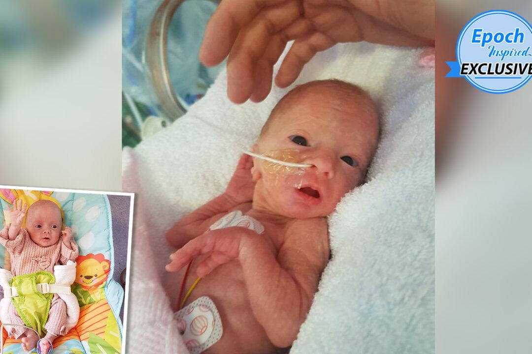 Baby Girl Born 13 Weeks Early Was Too Small for Doll Clothes, Now Thriving: ‘Our Little Fighter’