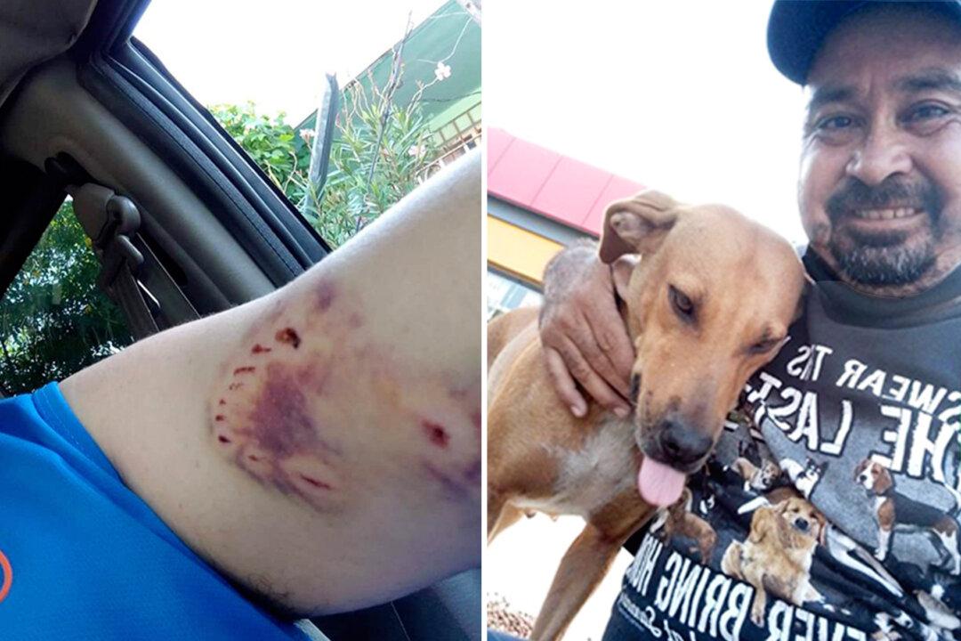 (Video) Man Keeps Feeding Stray Dog That Bit Him Hard; Now She Greets Him with Kisses